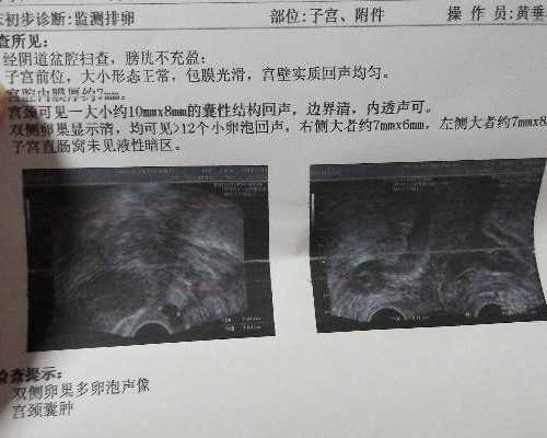试管婴儿**后的症状应对指南