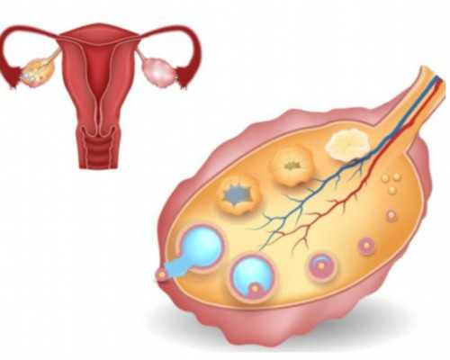 40岁肌瘤供卵自怀_专业代生,试管婴儿胚胎冷冻适合哪些女性移植?_人工周期胚胎