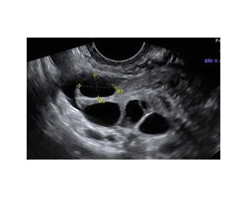安徽爱心捐卵贴吧-浙江正规捐卵哪里