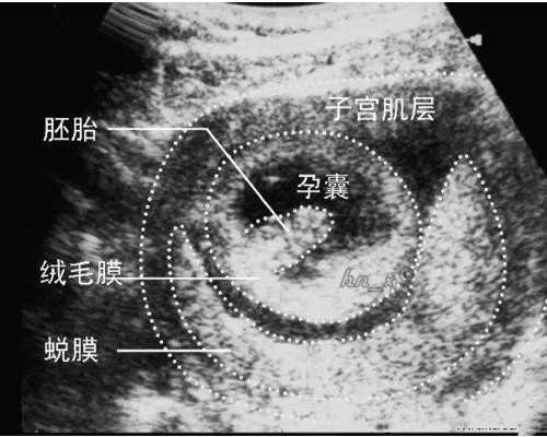 安徽人工受孕费用多少钱,安徽武警试管费用多少?6万够吗?