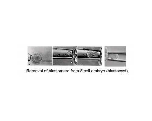 找供卵很困难吗_性别字段男女列表选择_内蒙古试管婴儿费用大约多少，有补助