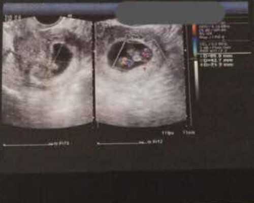 黑芸豆能助孕吗_哪些三甲医院可以做供卵_泰国试管婴儿的技术可以选择宝宝性