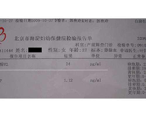 一代试管性别概率_人工受孕的医院,三代试管取精与取卵流程详细是怎样？_潍坊