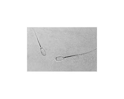 试管前期检查报告管多久？试管前期检查报告多长时间有效？*借卵自怀