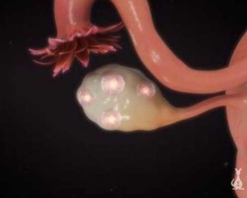 江西首例！28岁女子失去生育能力，一次手术让她看到希望