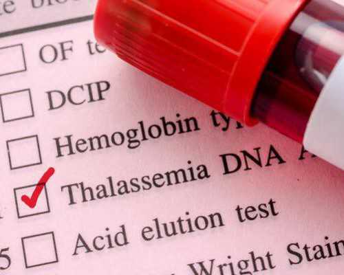 早孕彩超看不到孕囊正常吗*三代代孕机构
