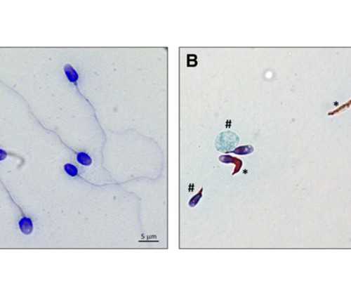 试管胎停后多久可以再次做？试管胎停后多久可以再次做宫腔镜？*代怀供卵生子