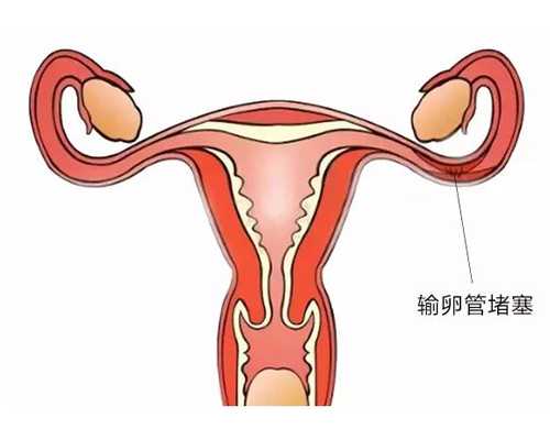 2026
个人代孕_专业代怀网,俄罗斯试管婴儿：不孕患者怎么疏解心理压力？_上海