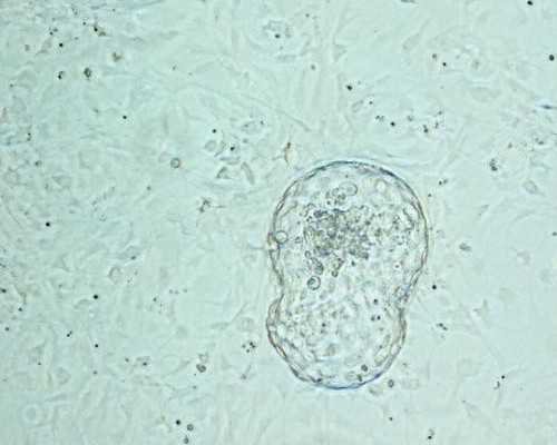 51宝贝助孕价格_2026代孕费用_昆明供卵试管生子 昆明做宫腔镜大概多少钱？有哪