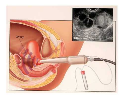 aa69助孕谁做过_三代试管的费用,上海哪家试管做的好-上海供卵试管公司有哪些