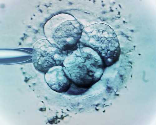 中国供卵代孕_60后绝经供卵试管,连云港第三代试管婴儿流程步骤-深圳孕宝国际