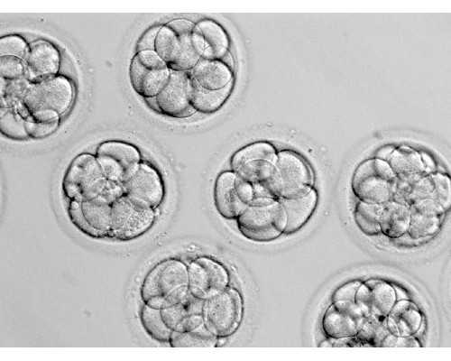 试管婴儿期间饮食并无太多禁忌，但也别太放飞自己