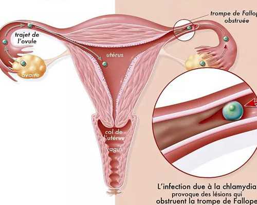 试管囊胚（养囊）移植的咨询