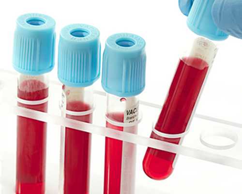 取卵前孕酮多少正常试管促排孕酮高说明什么