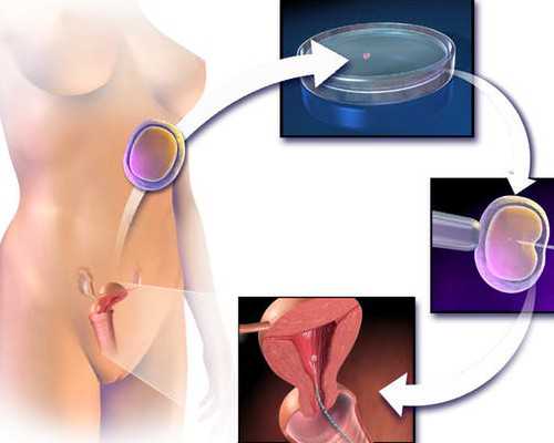 安徽国内供卵医院排名,安徽供卵生殖中心排名公布！附医院名单？