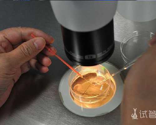 香港验血检测胎儿男女准确率高吗？为什么这么高？