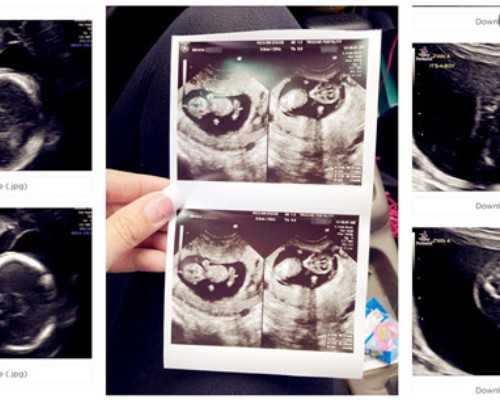 48岁供卵_哪些医院可以捐卵_美国试管婴儿40岁能要二胎吗？